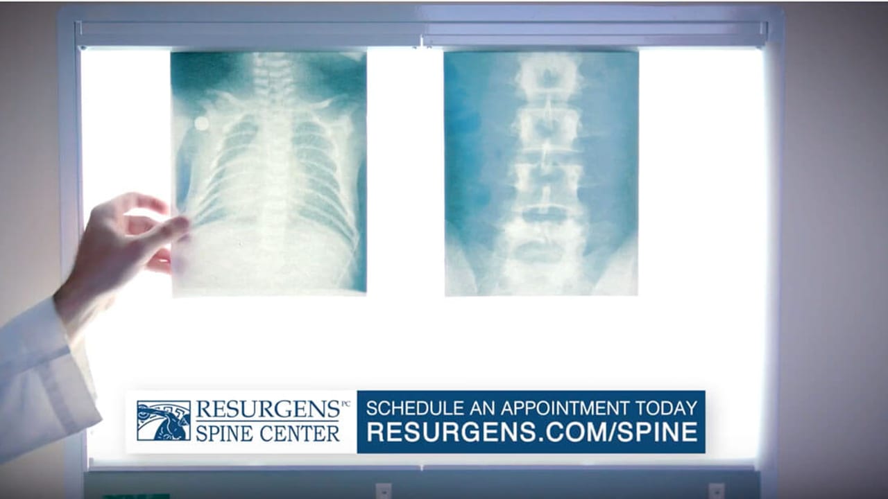 Resurgens Spine Center | 0:15 X-Ray Commercial article image for video marketing, brand storytelling, and campaign strategy.