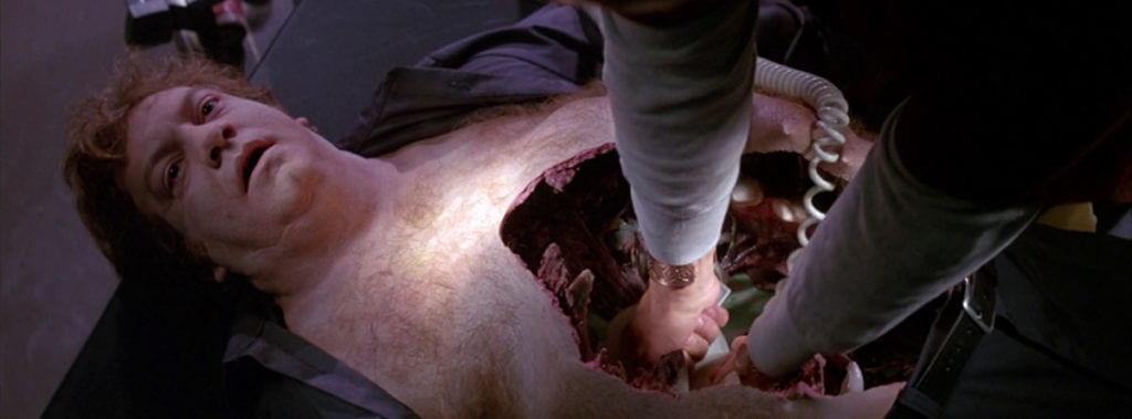 The Thing's "body-horror" special effects include a flatlining man with an abdomen cavity being shocked to life.
